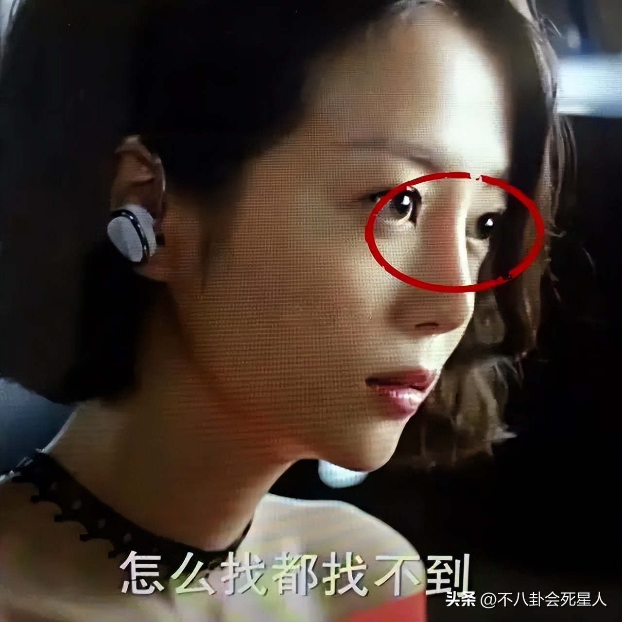 假双眼皮的明星,明星的假脸