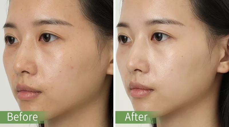 良心推荐敏感肌护肤,夏天好用的洁面推荐哪款