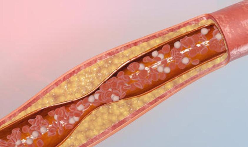 桥本甲状腺炎中医解释,中医对桥本氏甲状腺炎的认识