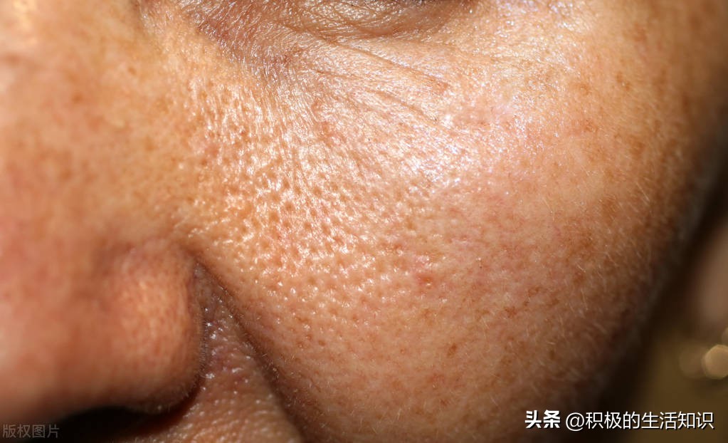 细腻毛孔与收缩毛孔精华,如何使皮肤变得细腻缩小毛孔