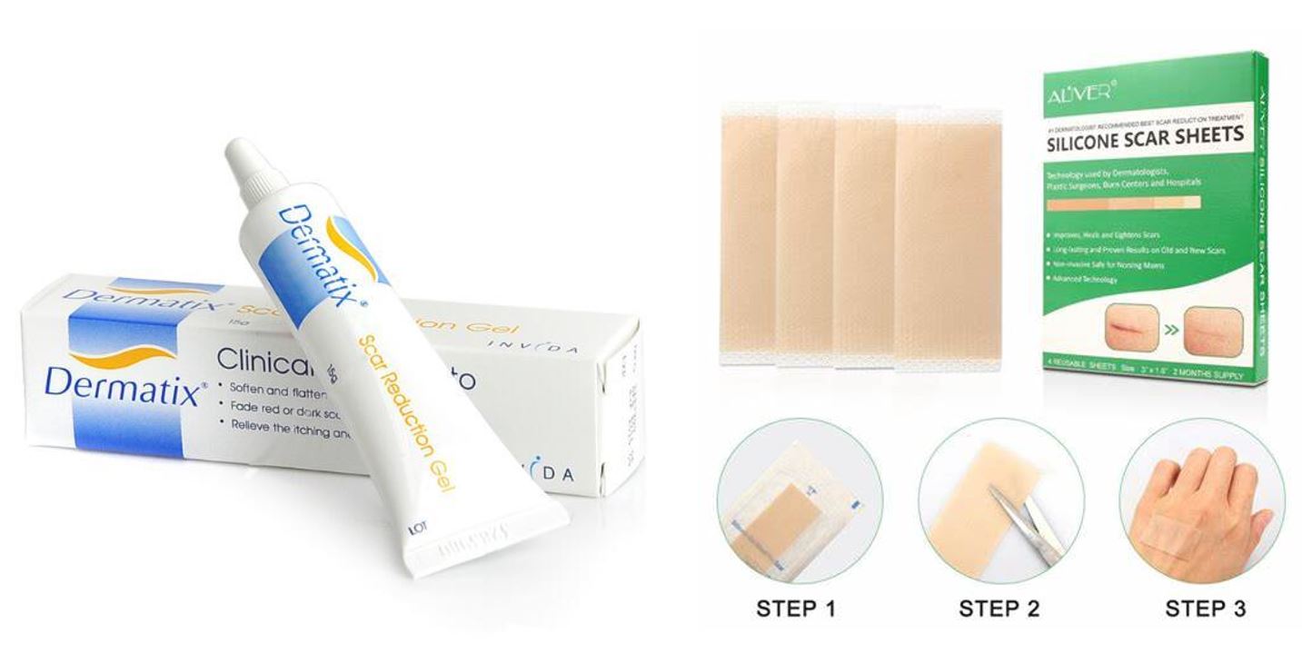 孩子碰伤了怎么祛疤痕,儿童凹陷性疤痕彻底修复方法