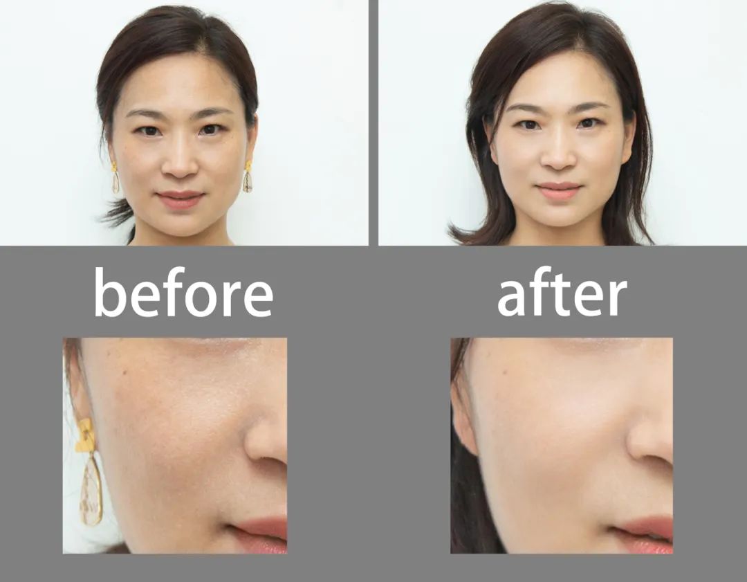 美肌试颜室‖直播见证，4周院线护肤的逆袭之路