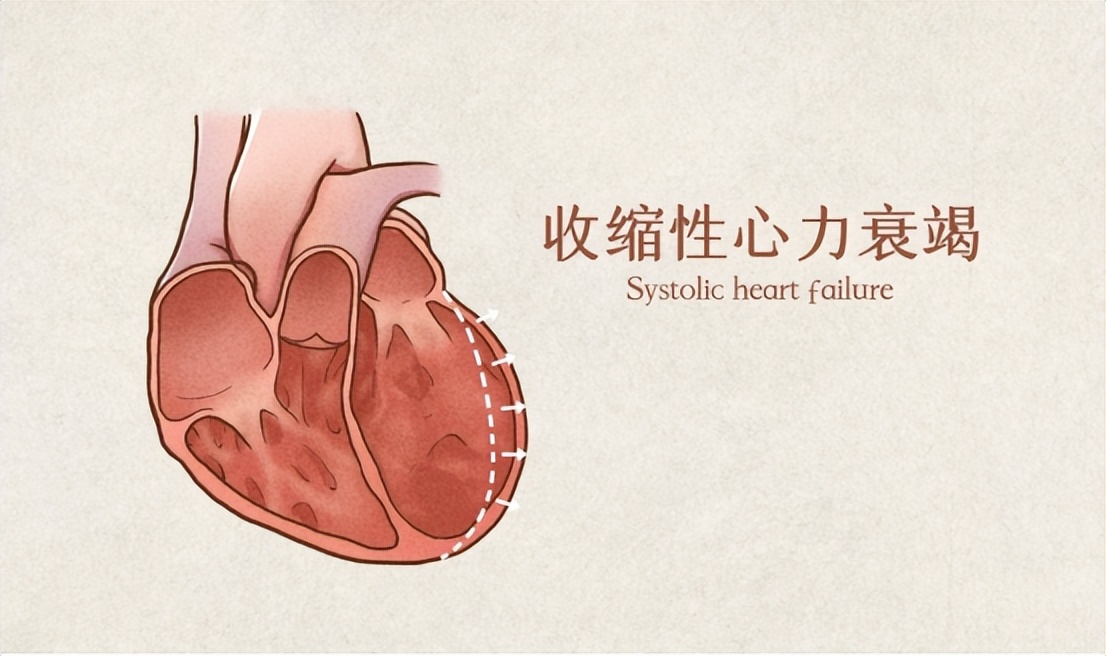 心衰的病因病机,心衰的原因和治疗方法有哪些