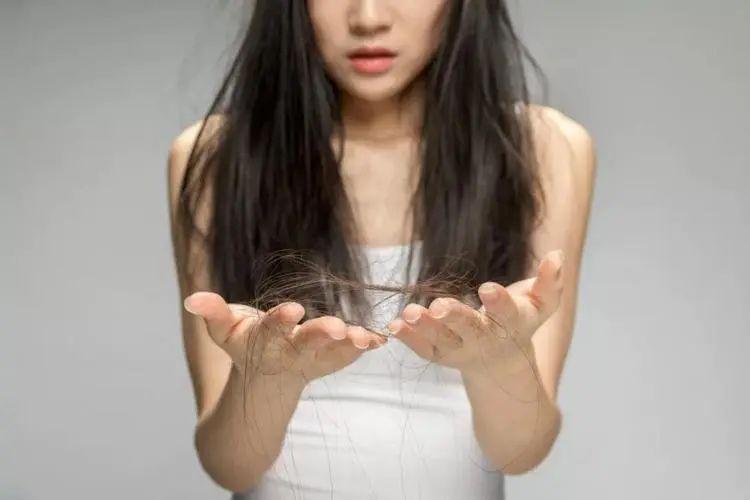 脱发产品排行榜10强,脱发护发产品排行榜