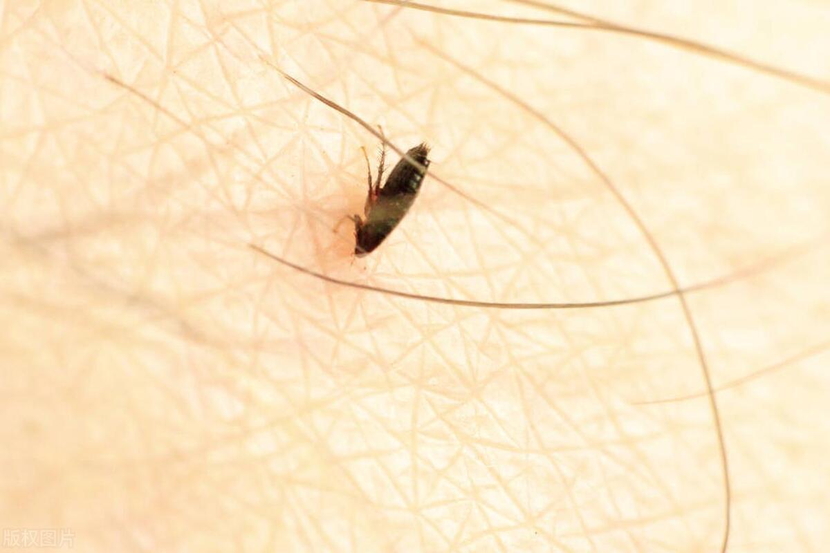 跳蚤药杀死跳蚤还是驱赶跳蚤,家里有跳蚤怎么彻底消除跳蚤咬