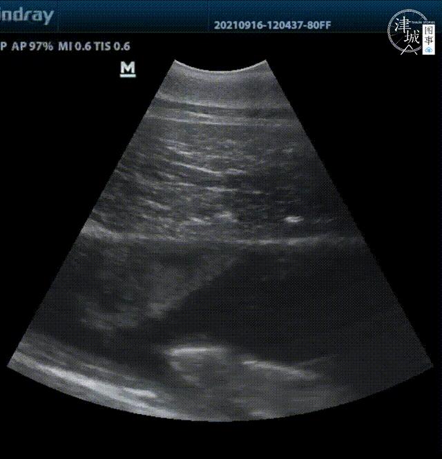 「津城图事」两个月颜值逆袭爹妈，天津这位“混血王子”可真好看