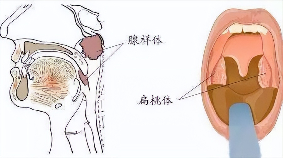 6岁孩子感冒好了睡觉突然打呼噜,孩子感冒打呼噜被憋醒