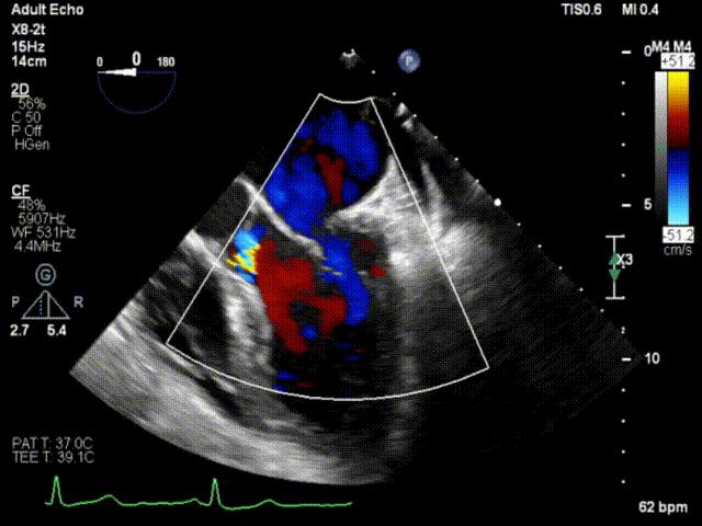 杨剑教授中国科学院,西京医院心血管外科杨剑