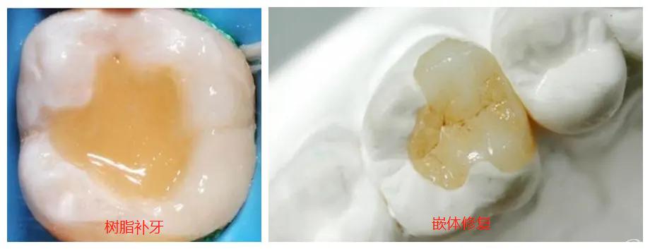 不要轻易拔掉牙齿,不要轻易拔牙