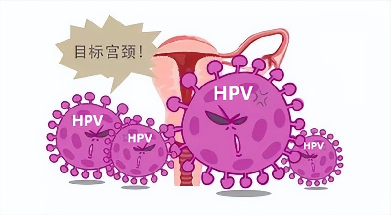 hpv一直不转阴有什么后果,感染hpv别拖着用3招hpv转阴不难