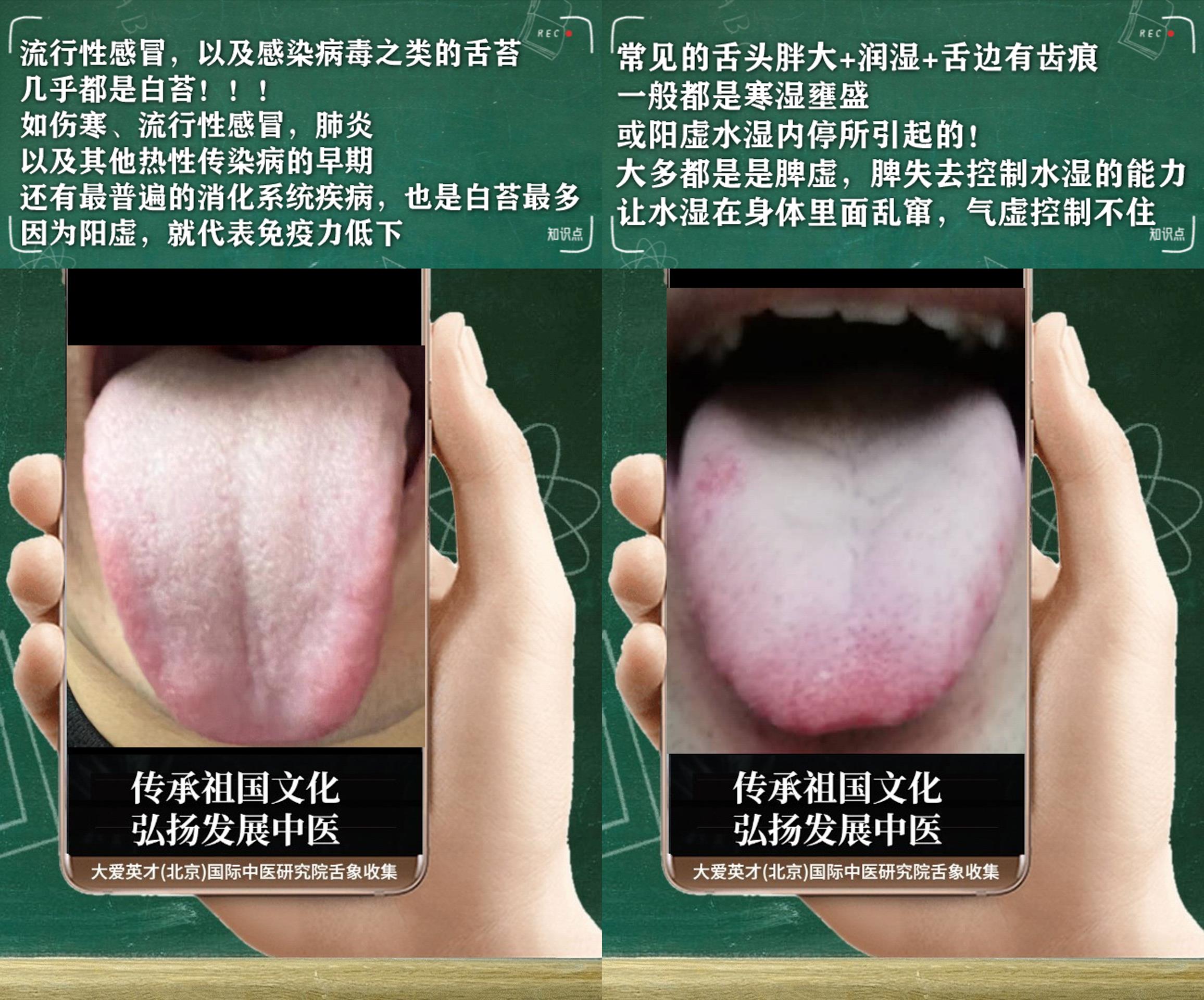 腰膝酸软中医辨证论治,中医腰膝酸软