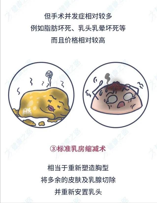 胸大好还是胸小比较健康,胸32a标准尺寸是小胸吗