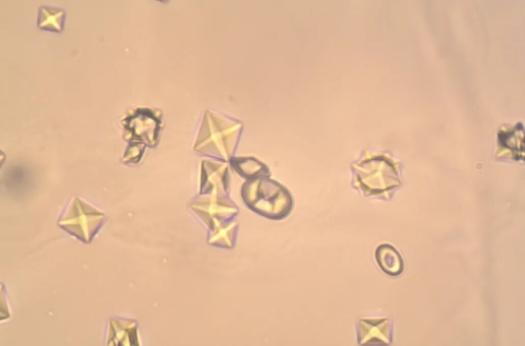 狗膀胱结石最好的治疗方法,狗子尿道结石会有什么表现