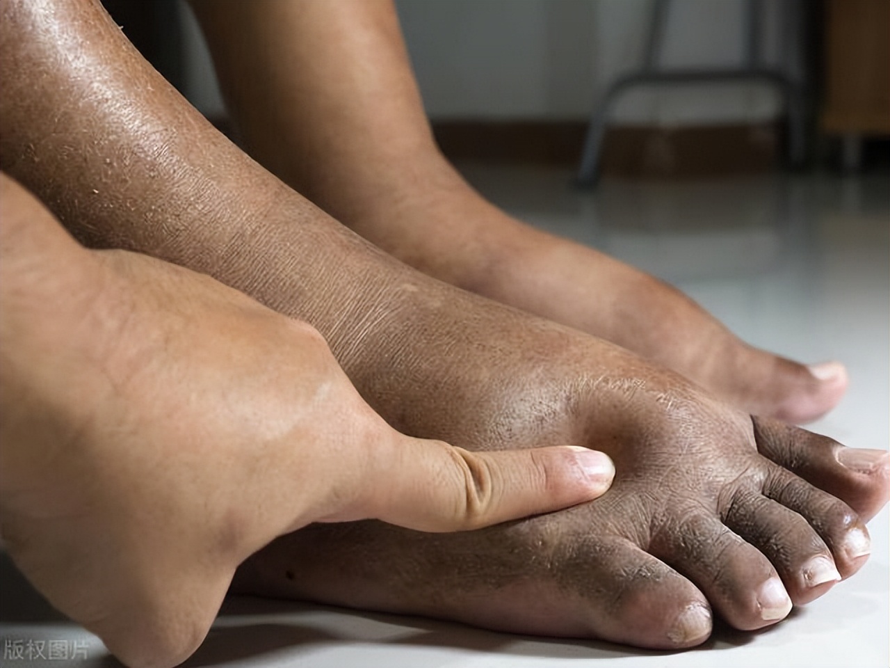 定期输液预防心脑血管病效果,定期输液能预防心血管病吗