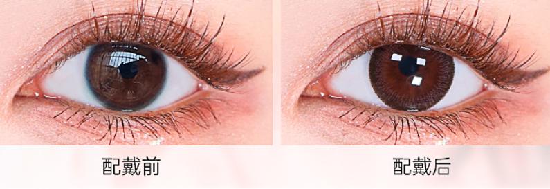 隐形眼镜区分正反,隐形眼镜专业知识测试