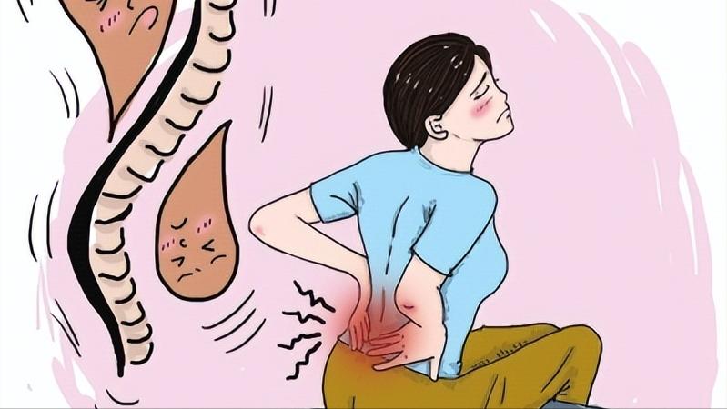 腰肌劳损导致腰疼最快缓解方法,腰肌劳损缓解腰痛的最佳动作