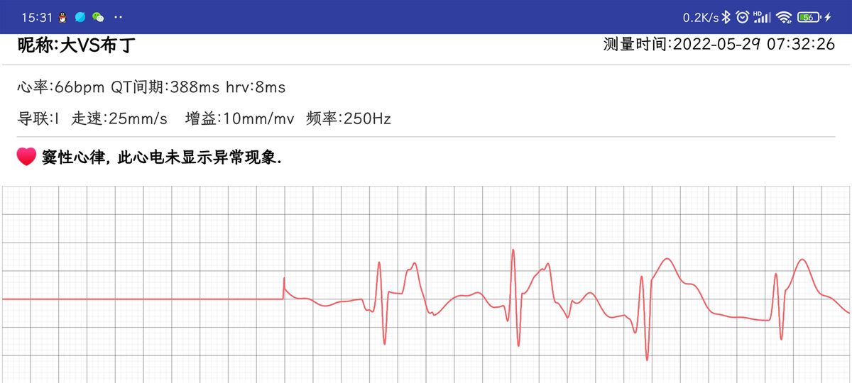 推荐一款性价比高的智能手环2017,2017年值得入手的智能手环