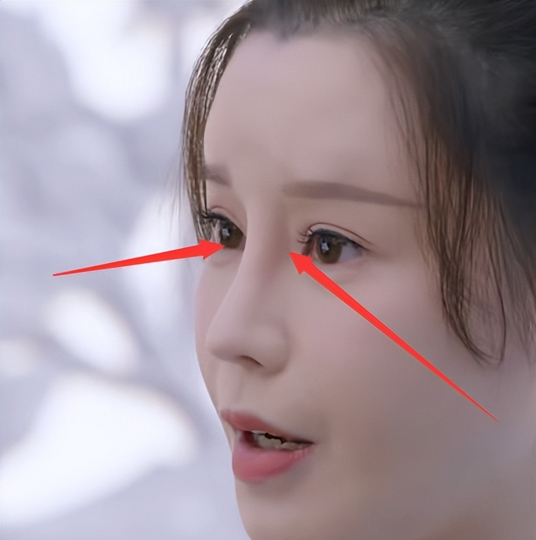 电视剧的整容脸,影视剧中整容脸