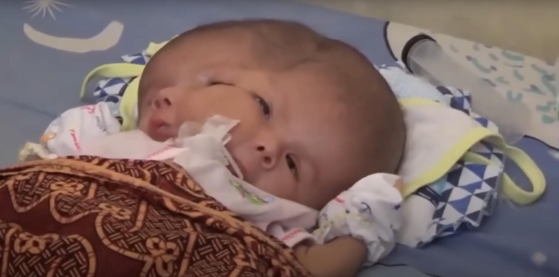 10个难以置信的人类，树皮人、外星人、拥有粗壮手臂的大力水手