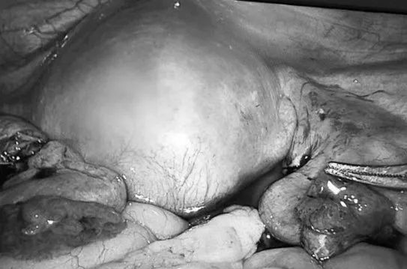 生命奇迹胎儿发育过程,生命的奇迹胎儿