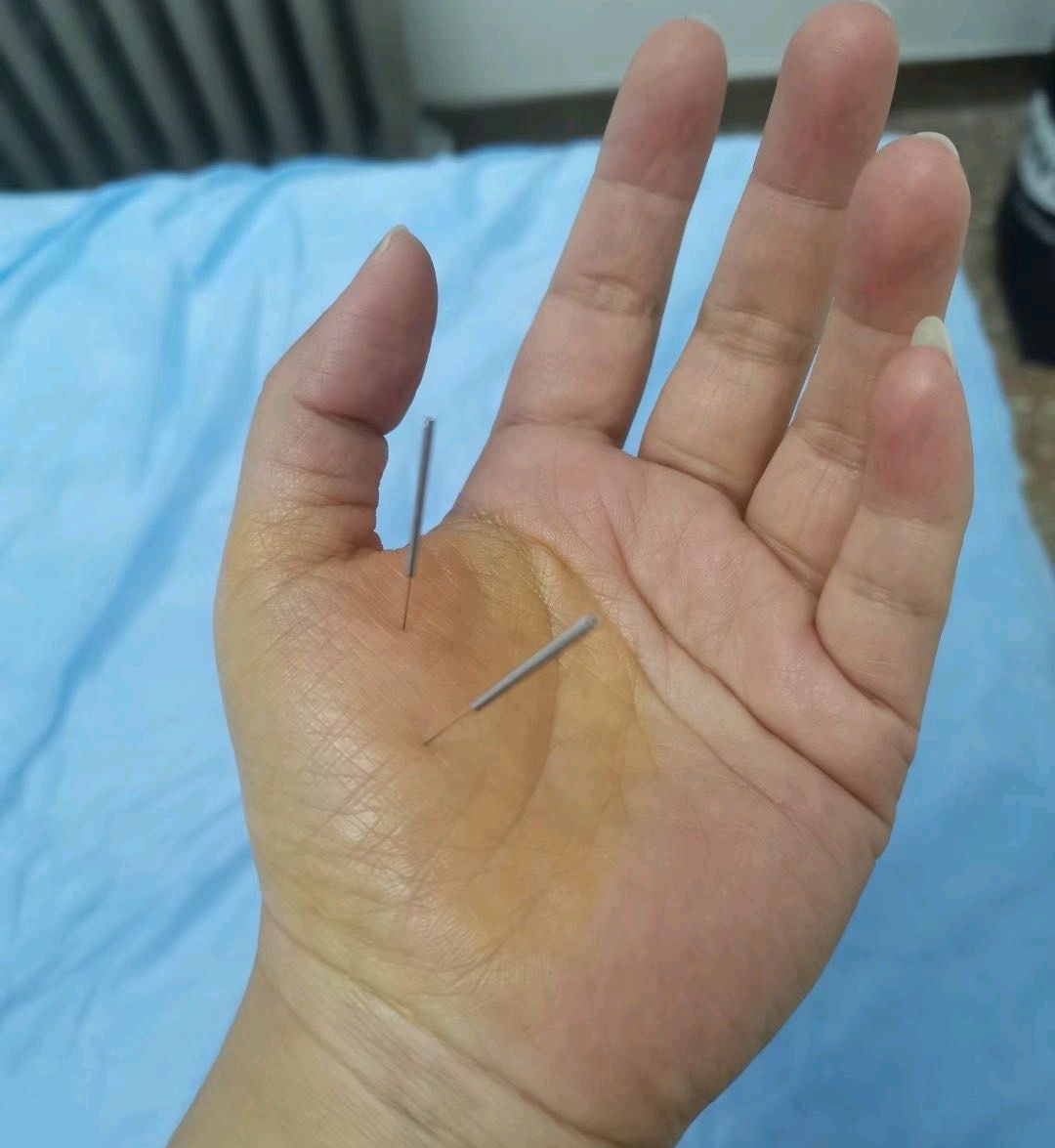 中医针灸大师邵经明教授，独创“三穴五针法”，治疗哮喘有奇效