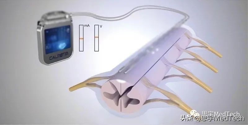 医疗器械公司奖励百万,微创医疗获1.5亿美元贷款