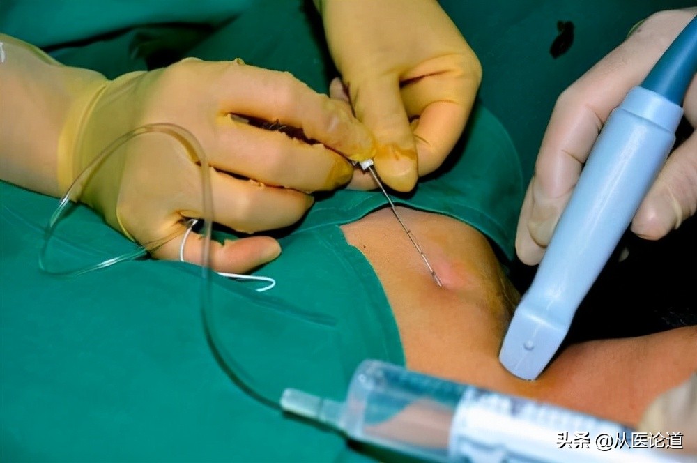 你是否被慢性疼痛所折磨？（根据黄家驷外科学第八版整理）