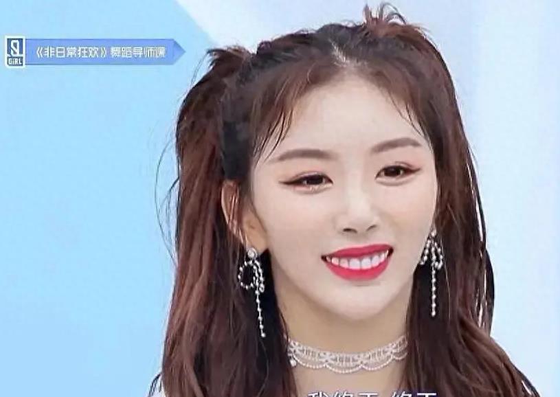 明星烤瓷牙发黑,明星烤瓷牙牙齿磨小后照片