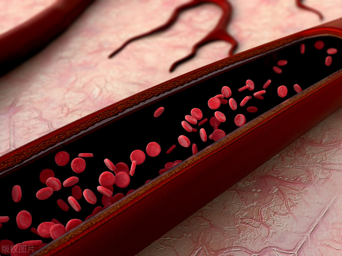 强效高血压特效药,高血压治疗器