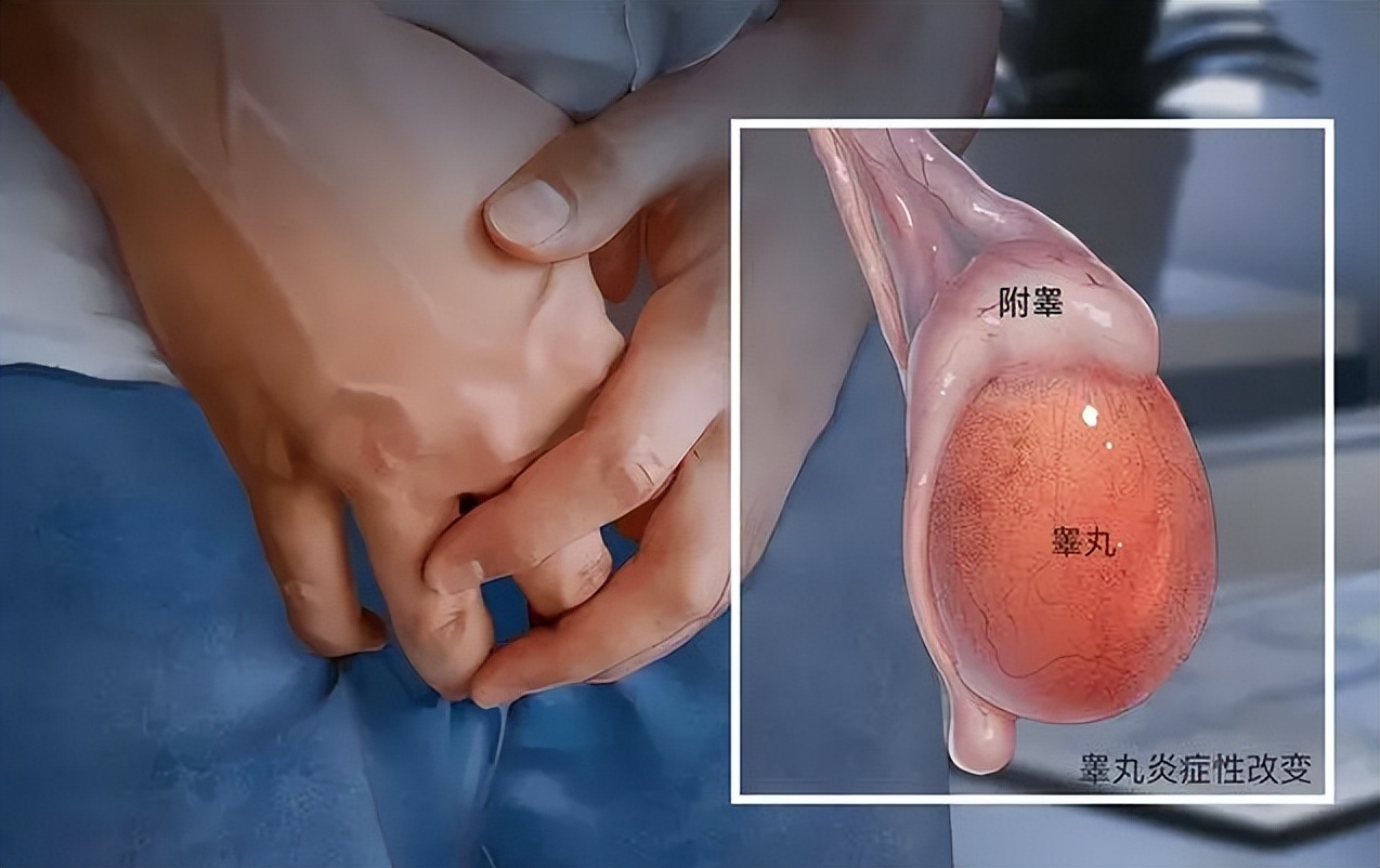 男性有前列腺炎会影响要孩子吗,慢性前列腺炎影响男性生殖功能