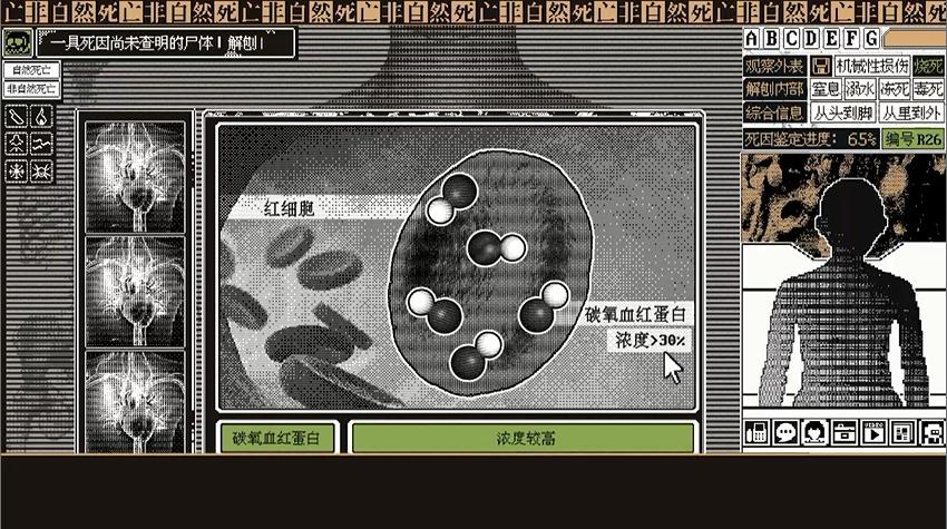 非自然死亡七大死因,自然死亡的具体死因