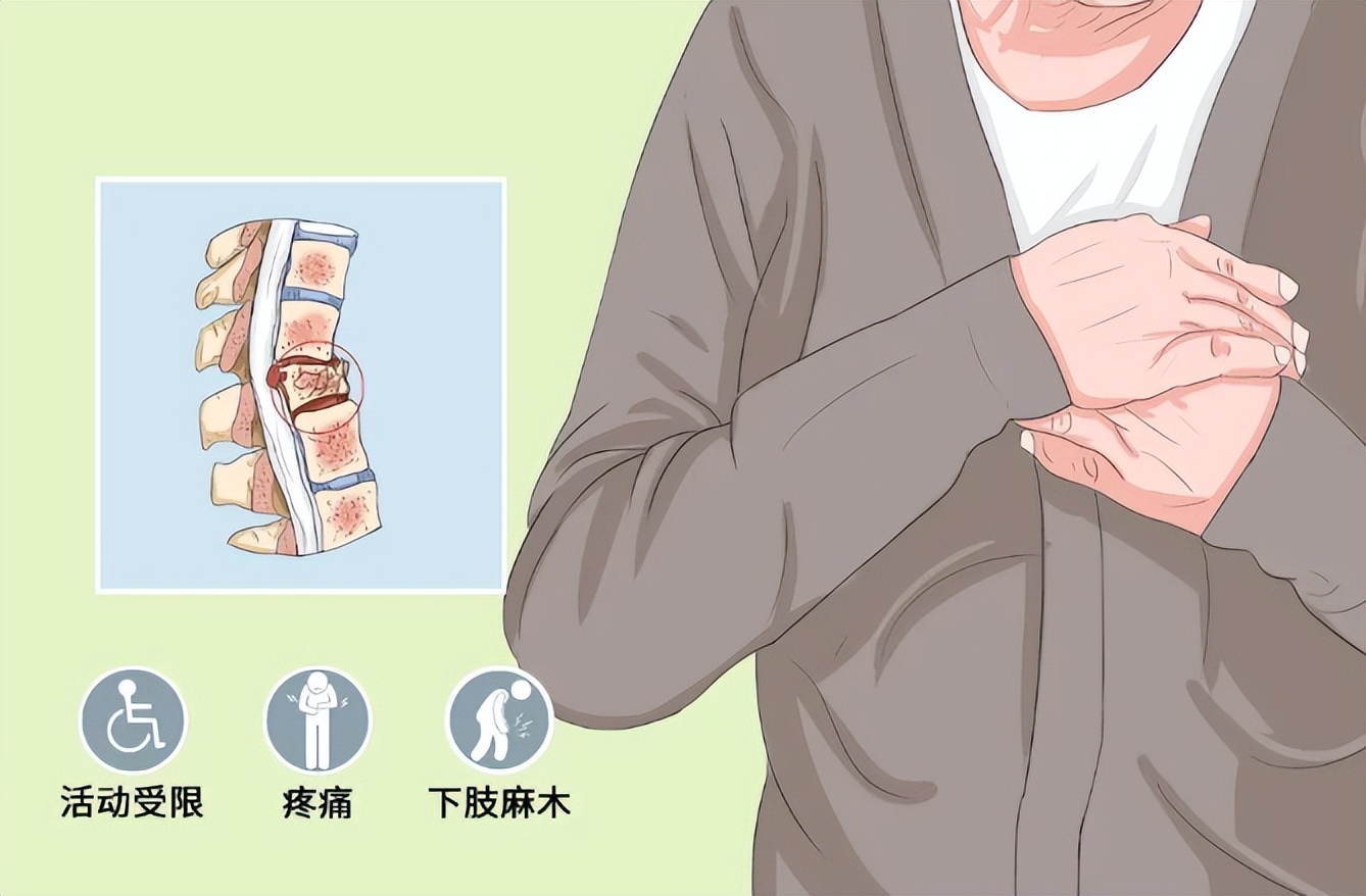 80岁老人腰椎骨折有必要做手术吗,老人腰椎骨折了不做手术还会好吗