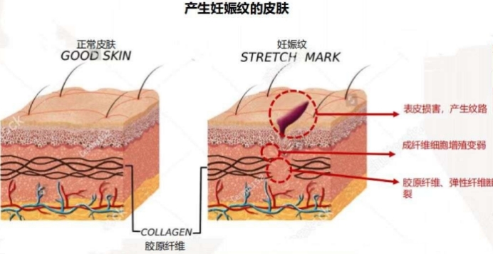孕前孕后都能穿的裙子秋冬,产前产后都可以穿的裙子