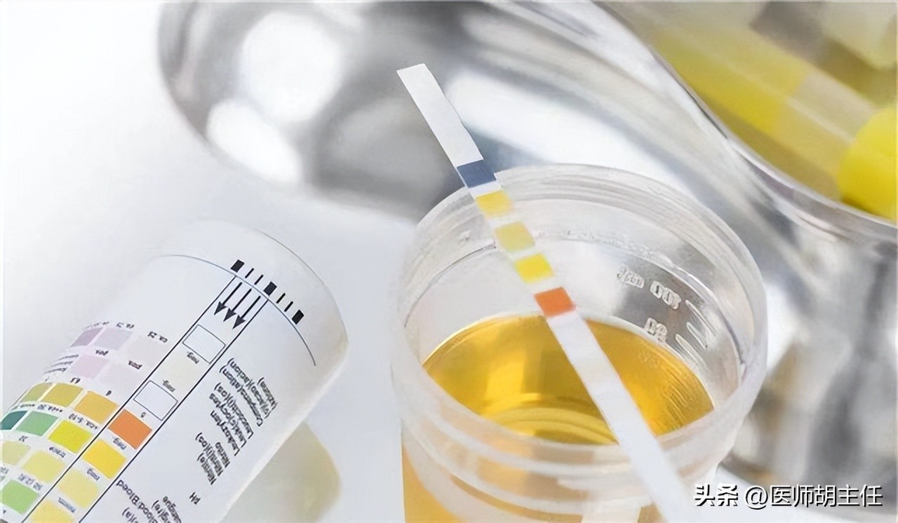 非布司他是目前最好的痛风药,非布司他治疗痛风的效果如何