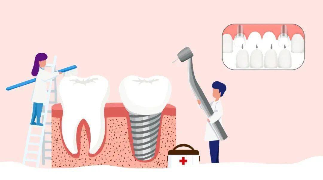 种植牙一颗多少钱能用多久,哪个种植牙医生技术好
