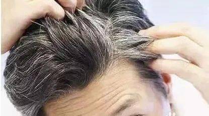 补肾精亏虚金锁固精丸,肾气不固肾精亏虚吃什么中药方剂