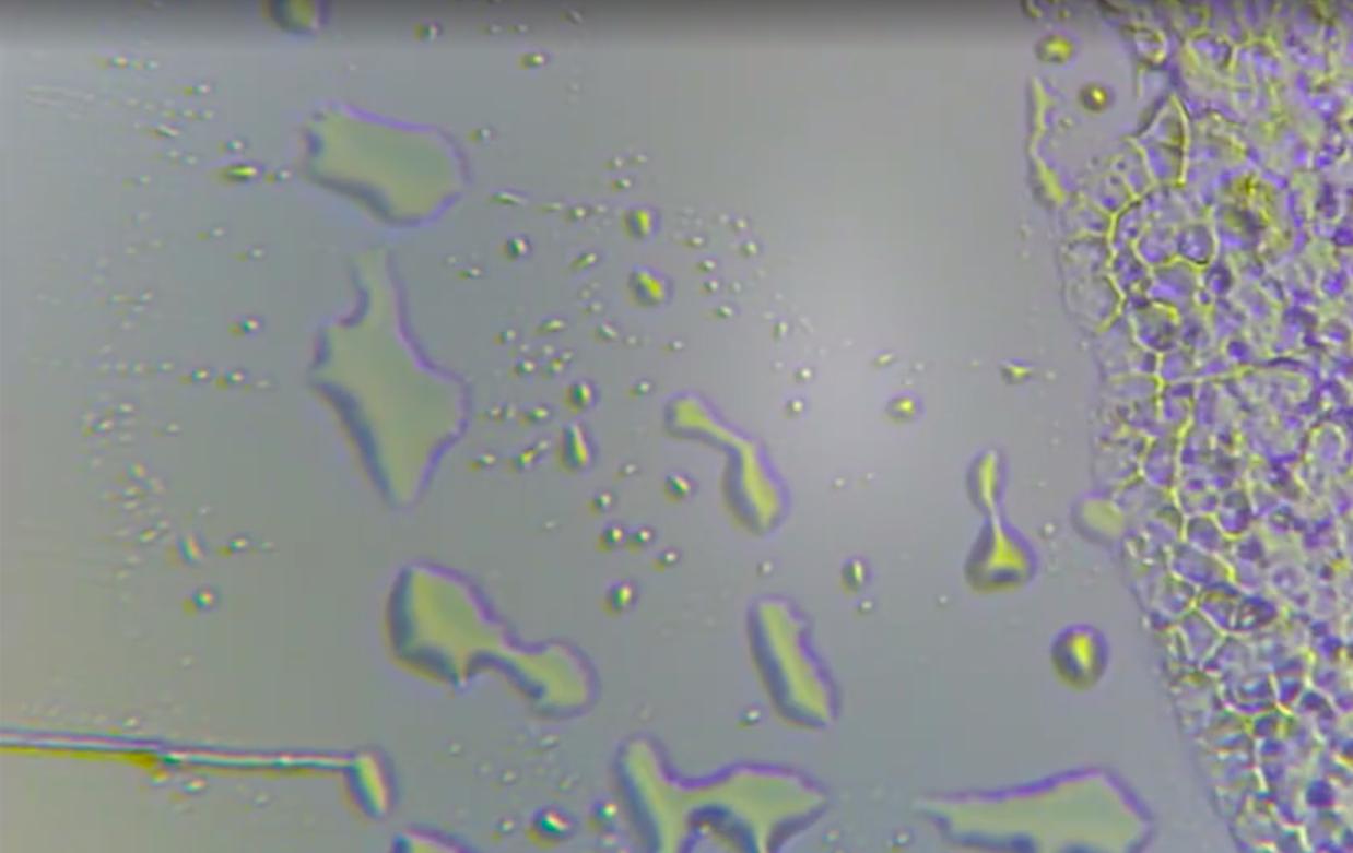 黑头在显微镜上是什么东西,脸上的黑头