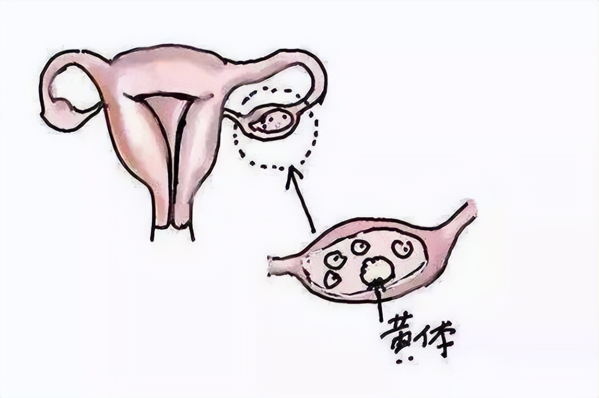 黄体二次破裂是什么原因,黄体二次破裂的可能性