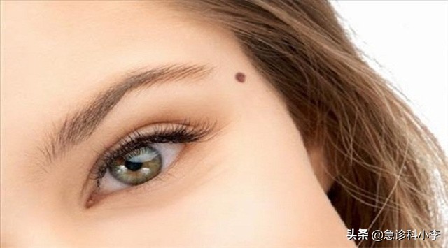 孩子身上小红点不痛不痒是什么病,身上起小红点不痛不痒按压会消失