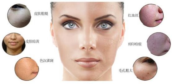 皮肤暗沉显黄显黑怎么办,皮肤暗沉粗糙改善方法
