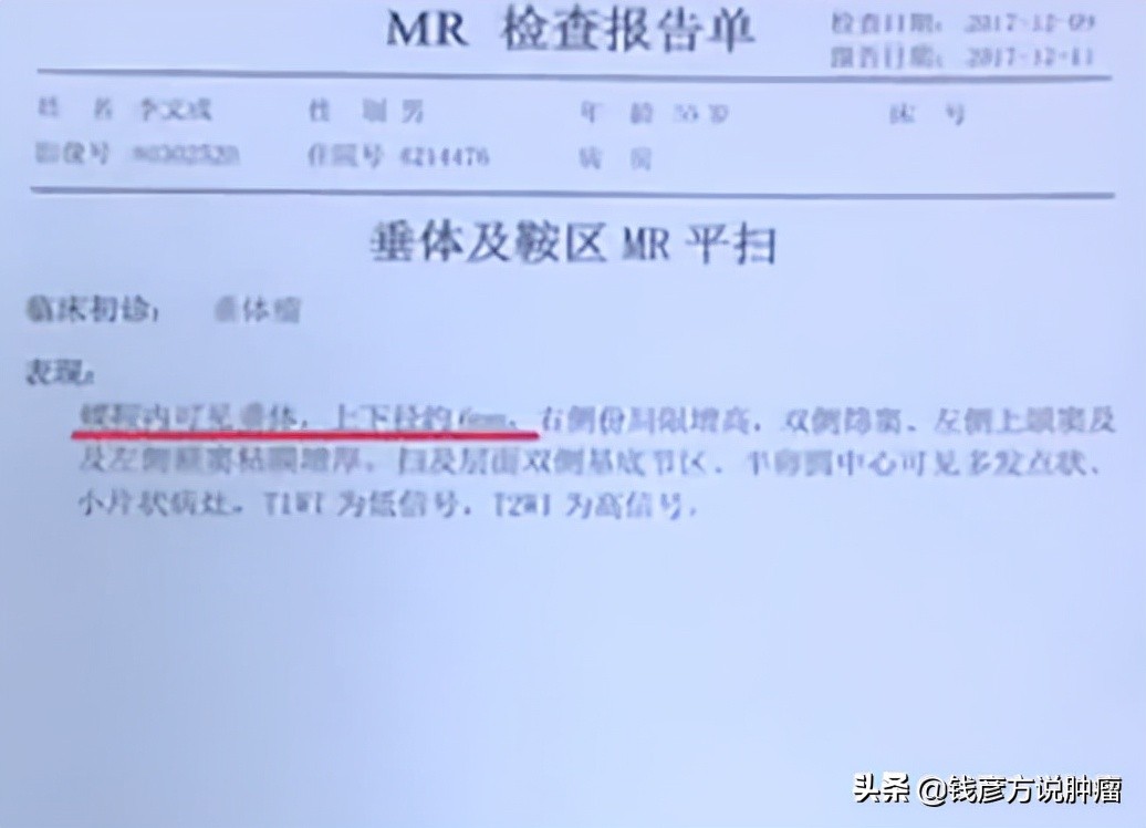 头晕被诊断为脑梗死危险吗,头晕轻度高血压该怎么办