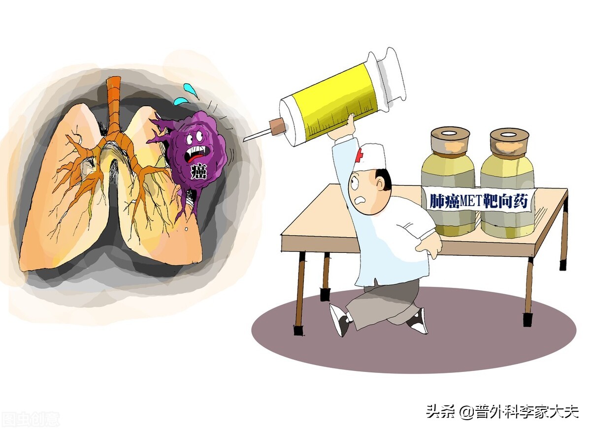 肺腺癌Ⅱb期的郭某是如何抗癌成功的？