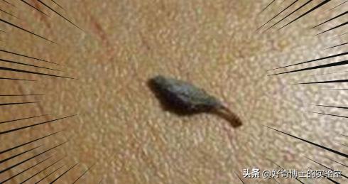 床上小颗粒是什么虫卵,墙上有虫卵很小颗粒