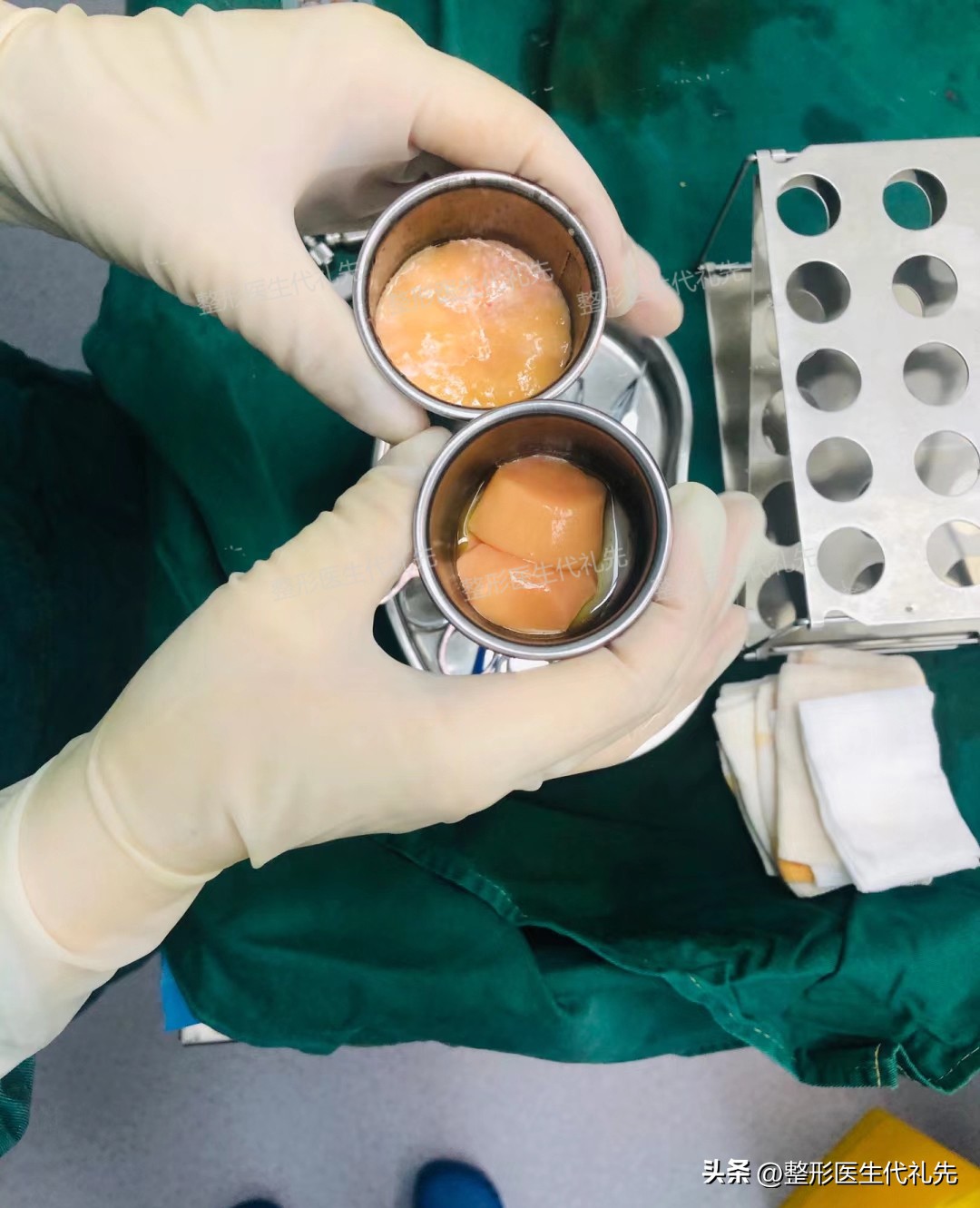 阔面脸如何变高级,阔面脸怎么变成窄面脸