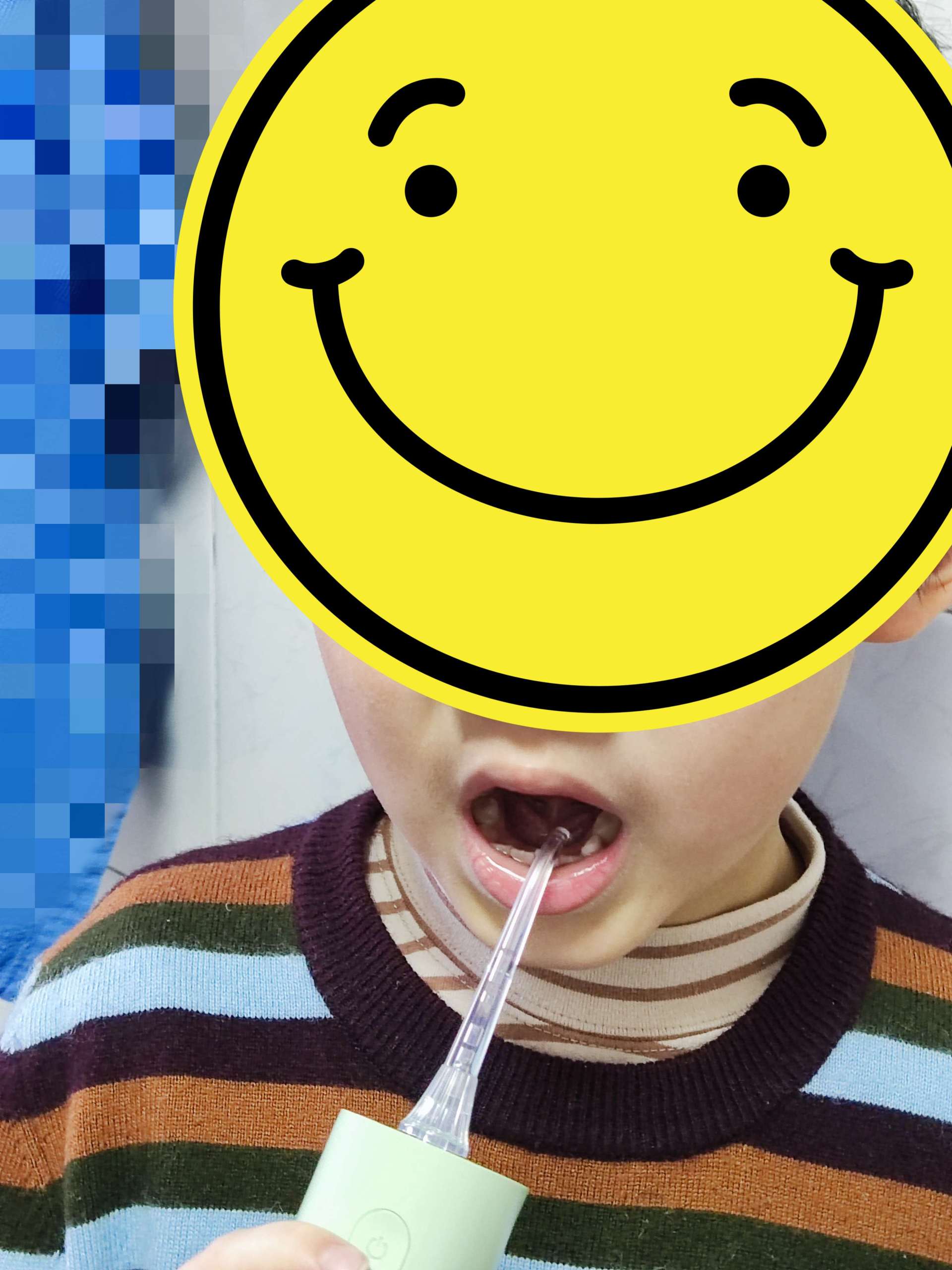 小孩换牙可以戴矫正器吗,小孩换牙时能用电动牙刷吗