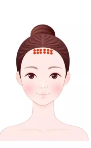 治疗痘痘和痘印最有效的产品内调,腮边反复长大硬包痘痘怎么内调