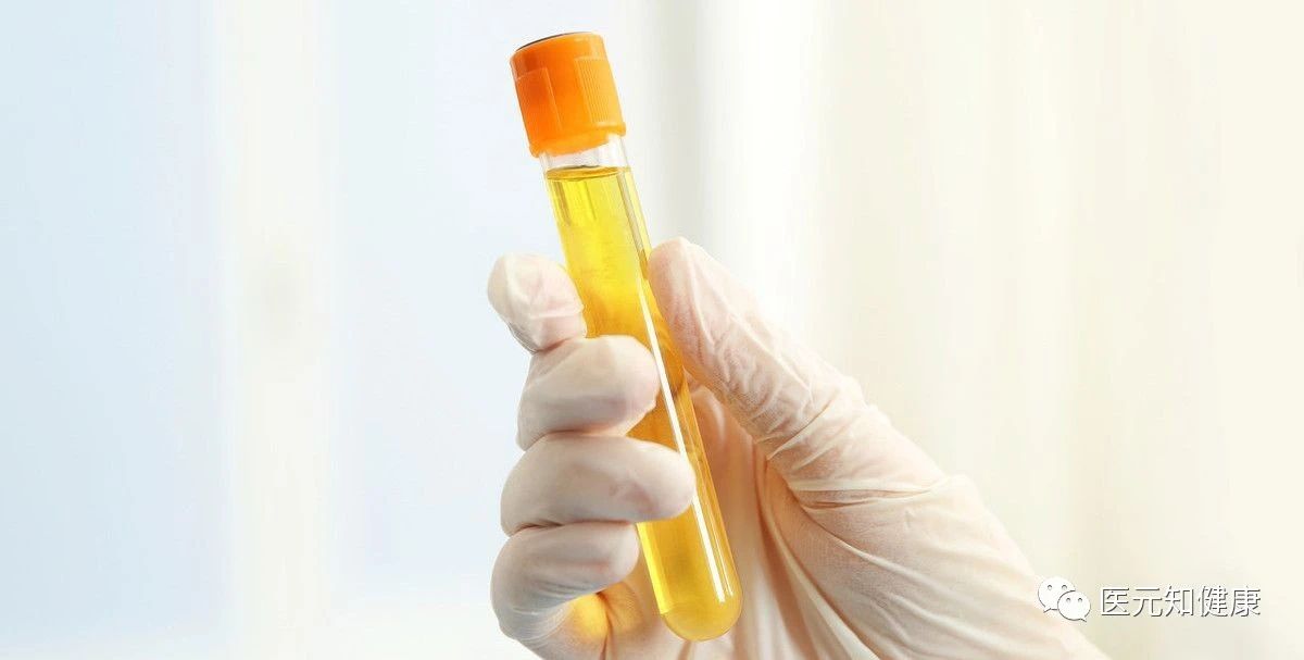 小便像黄豆油黄是怎么回事,小便发黄还有黄渣怎么回事