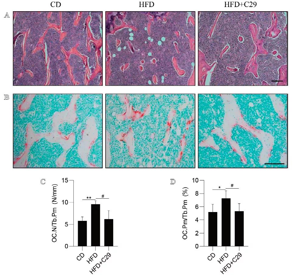 ERRα拮抗剂Compound29抑制破骨细胞改善肥胖引起的骨丢失