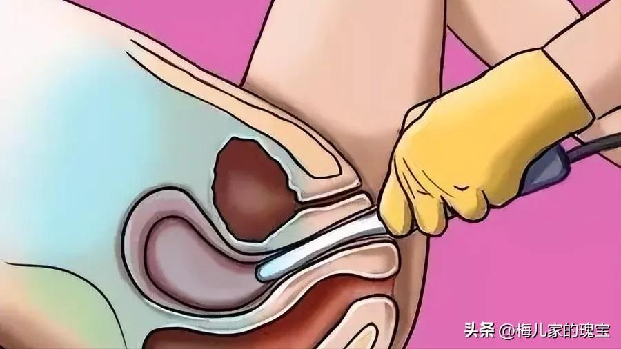 两次阴超检查男医生更温柔，动武的男人心胸狭隘，女医生能胜任吗