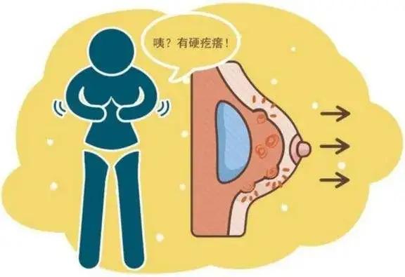 如果没有这个现象，乳房一大一小是正常的